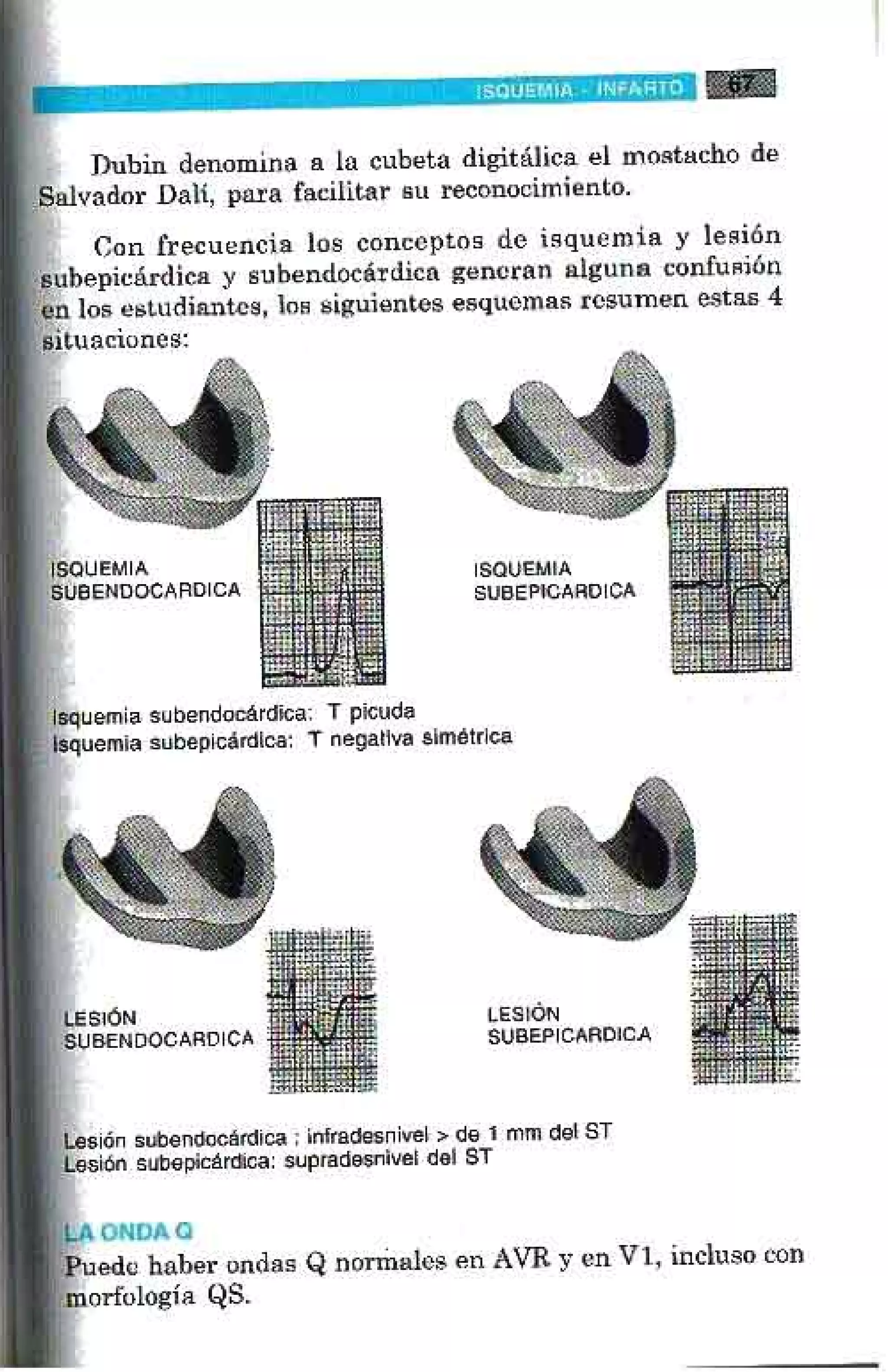 LA ALEGRIA DE LEER EL ELECTROCARDIOGRAMA