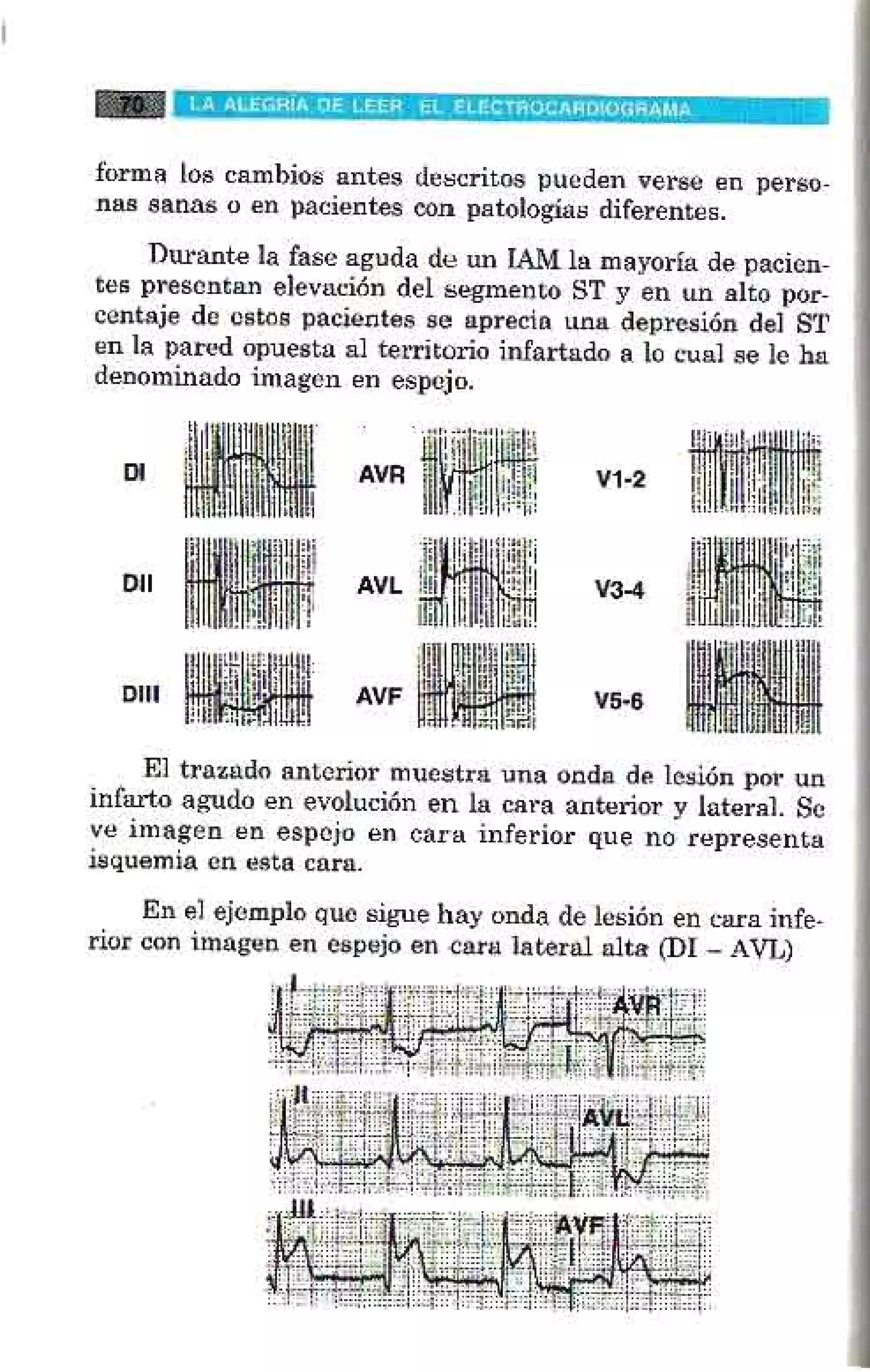 LA ALEGRIA DE LEER EL ELECTROCARDIOGRAMA