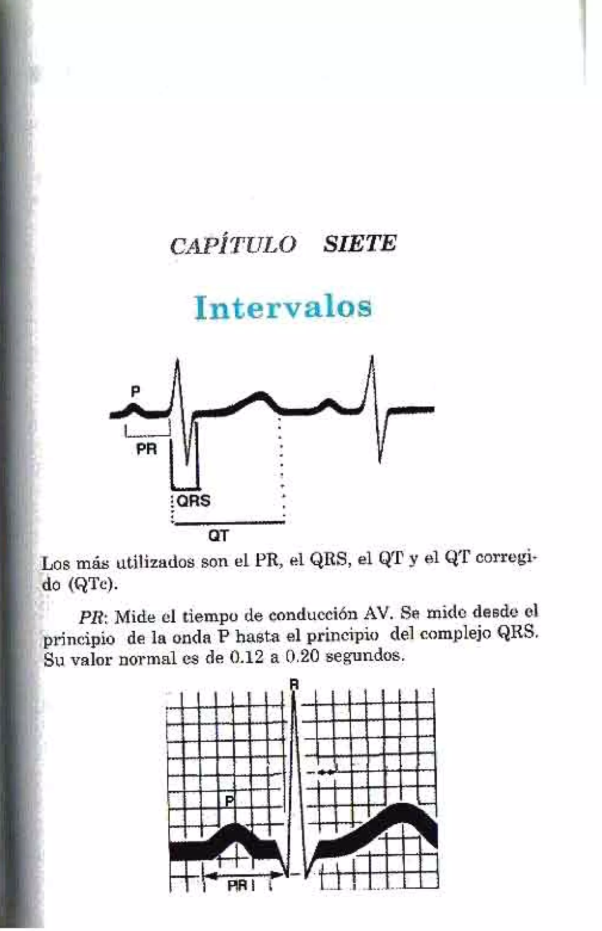 LA ALEGRIA DE LEER EL ELECTROCARDIOGRAMA