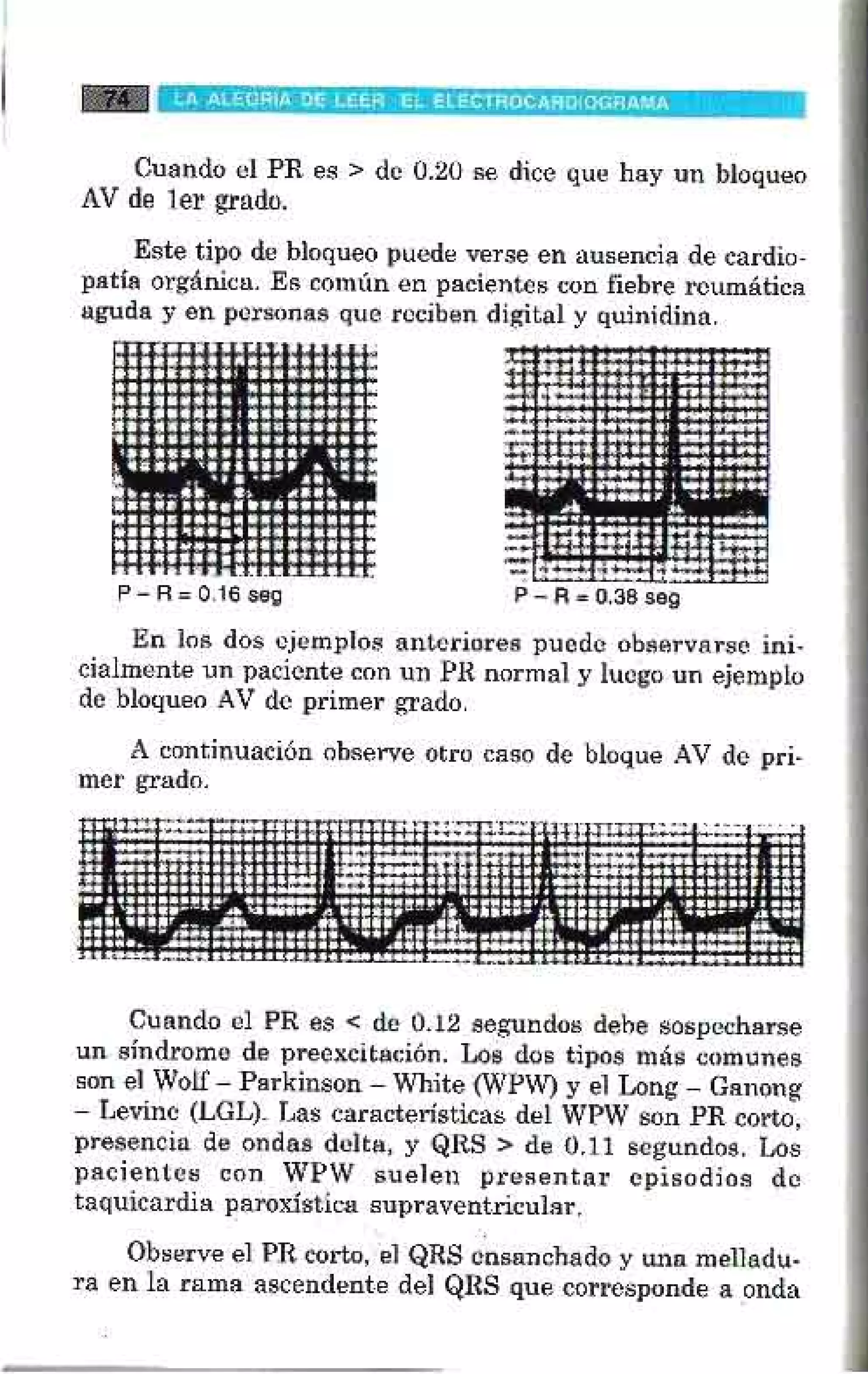 LA ALEGRIA DE LEER EL ELECTROCARDIOGRAMA