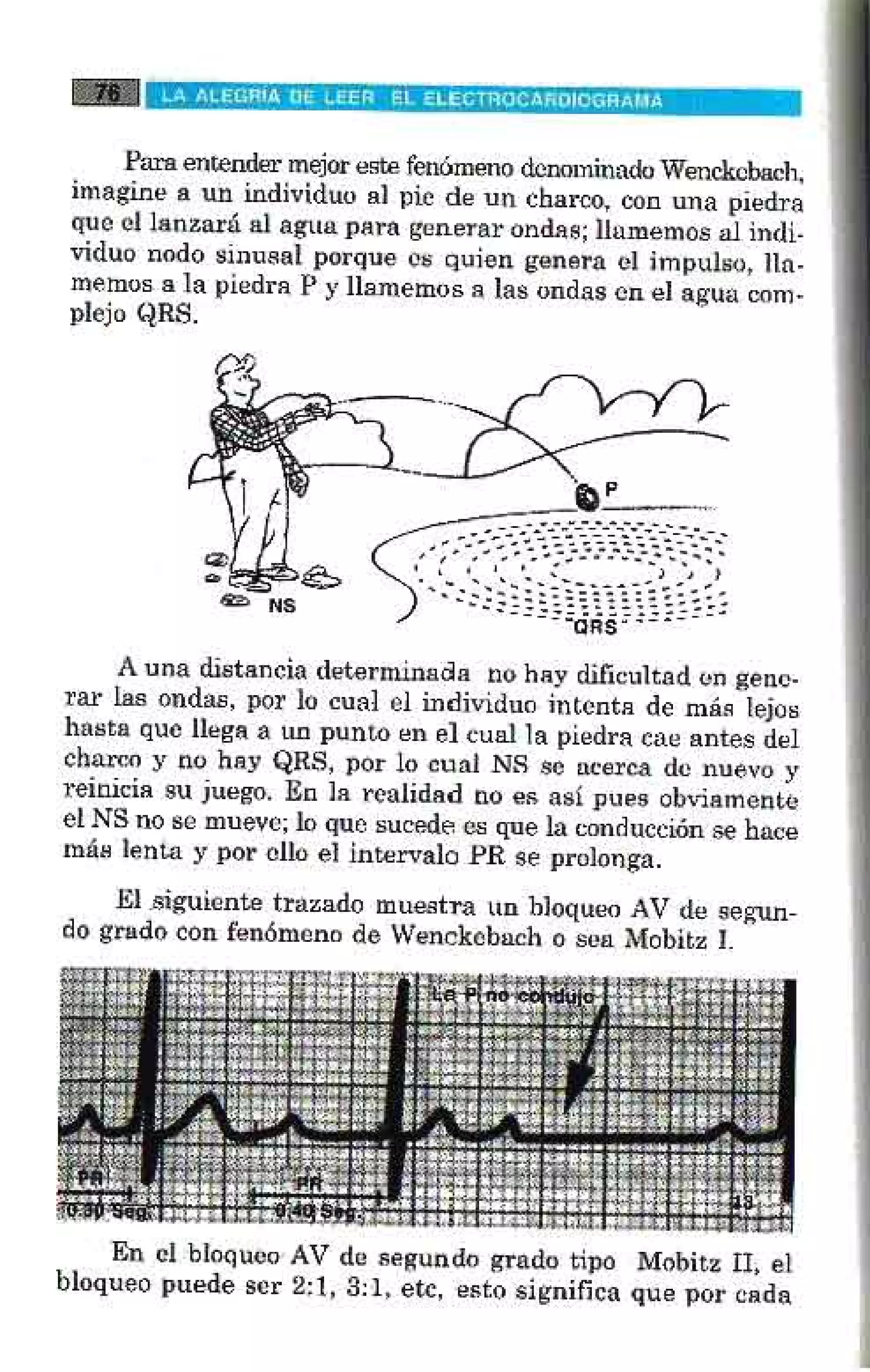 LA ALEGRIA DE LEER EL ELECTROCARDIOGRAMA