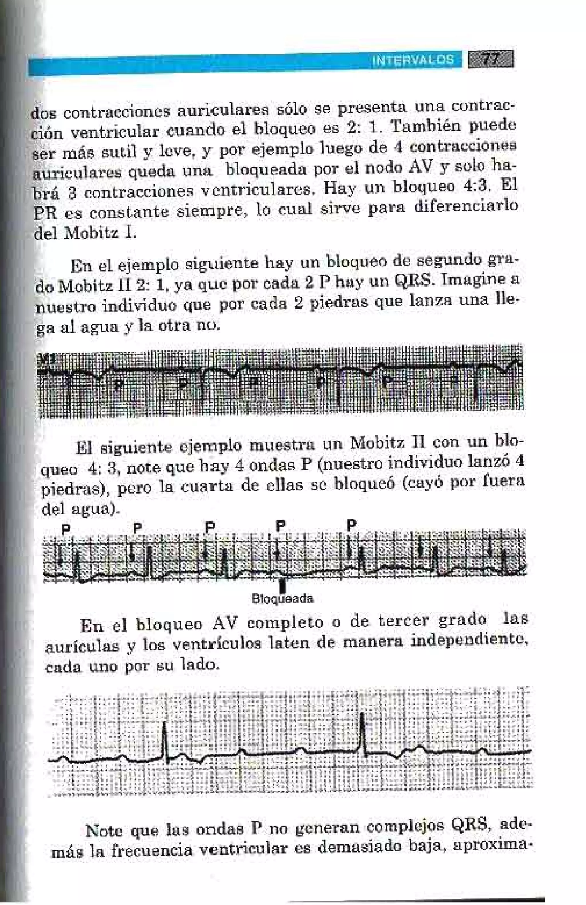 LA ALEGRIA DE LEER EL ELECTROCARDIOGRAMA