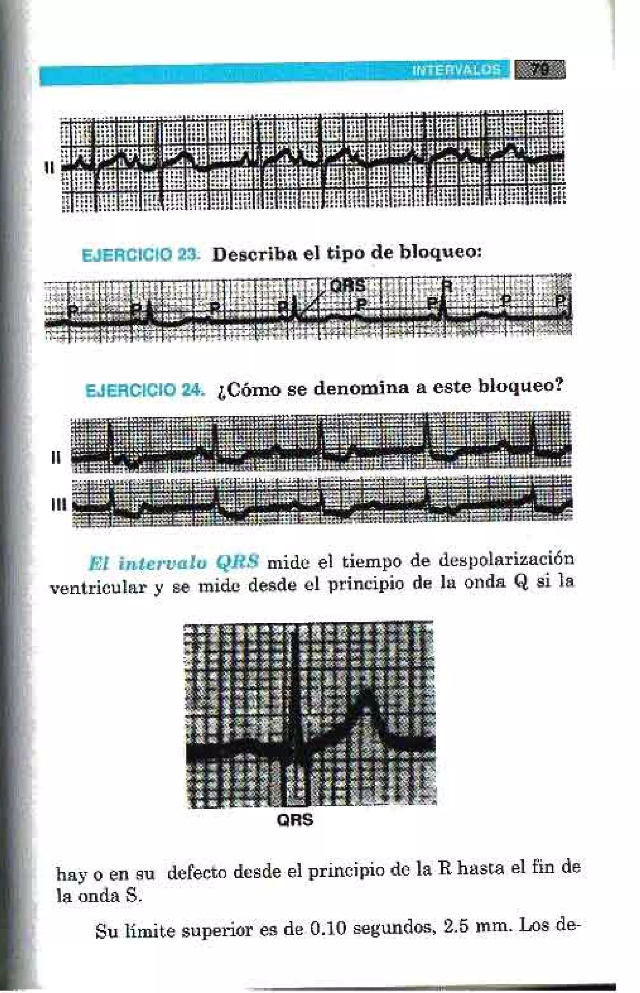 LA ALEGRIA DE LEER EL ELECTROCARDIOGRAMA
