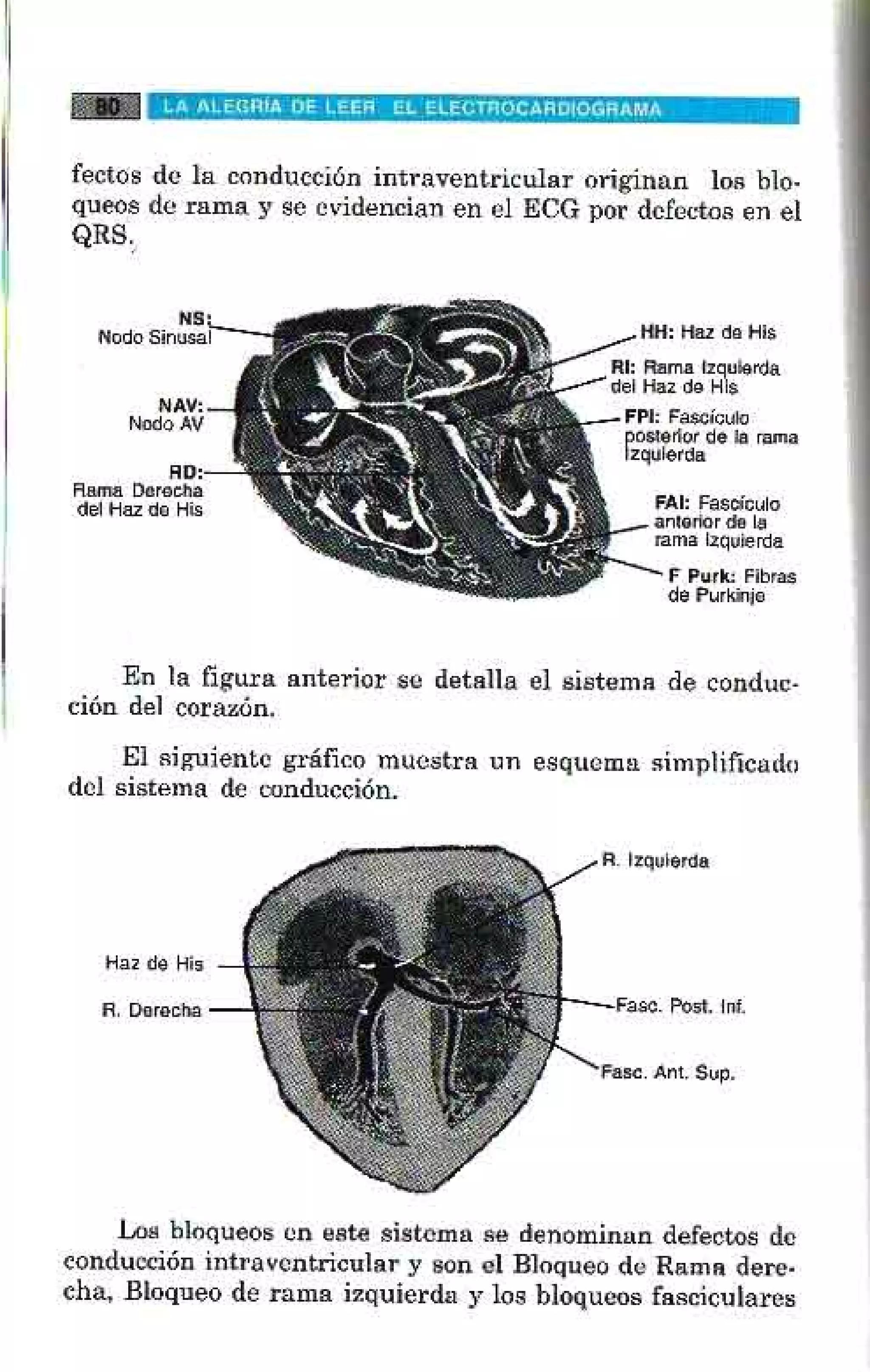 LA ALEGRIA DE LEER EL ELECTROCARDIOGRAMA
