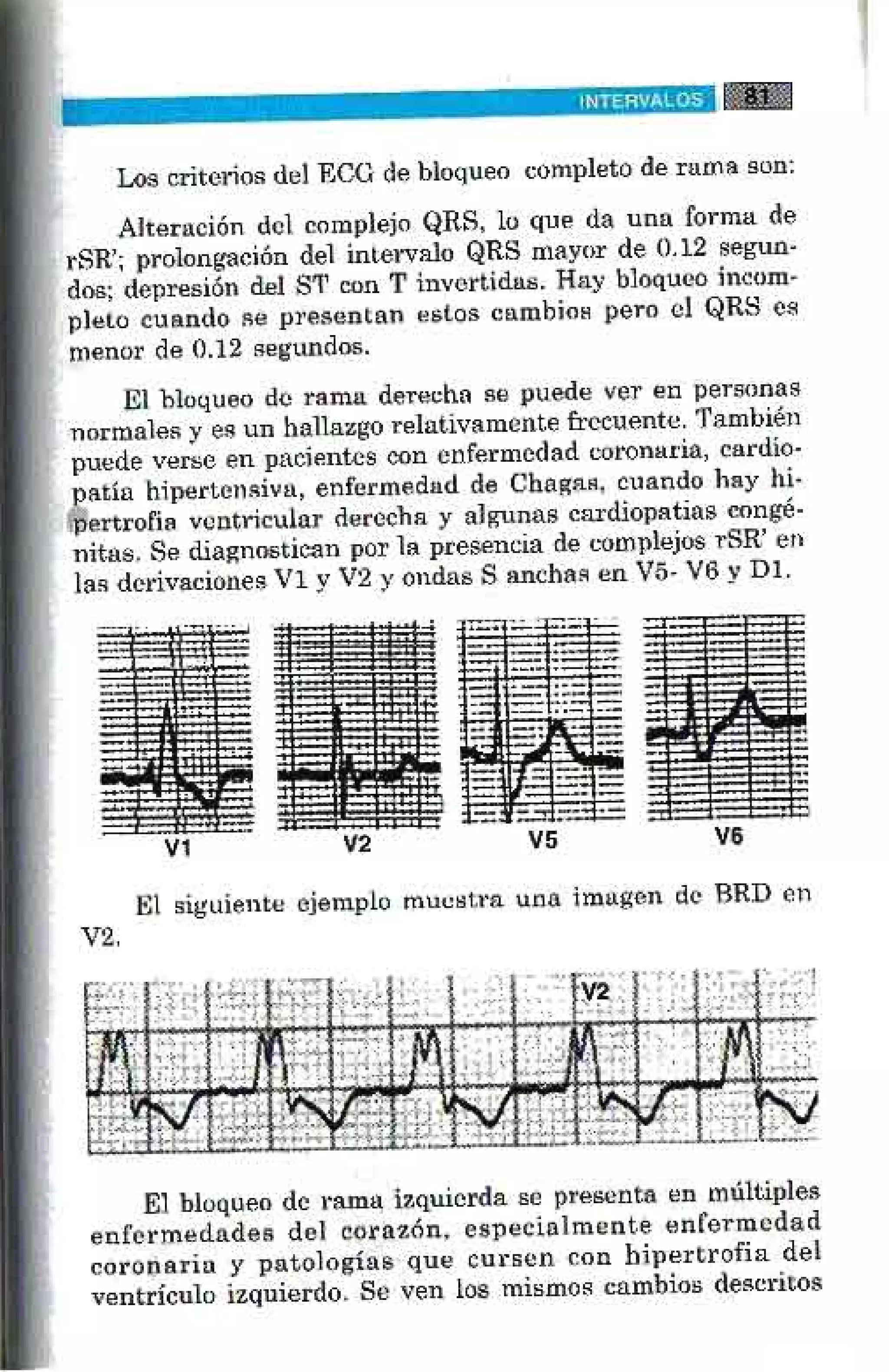 LA ALEGRIA DE LEER EL ELECTROCARDIOGRAMA
