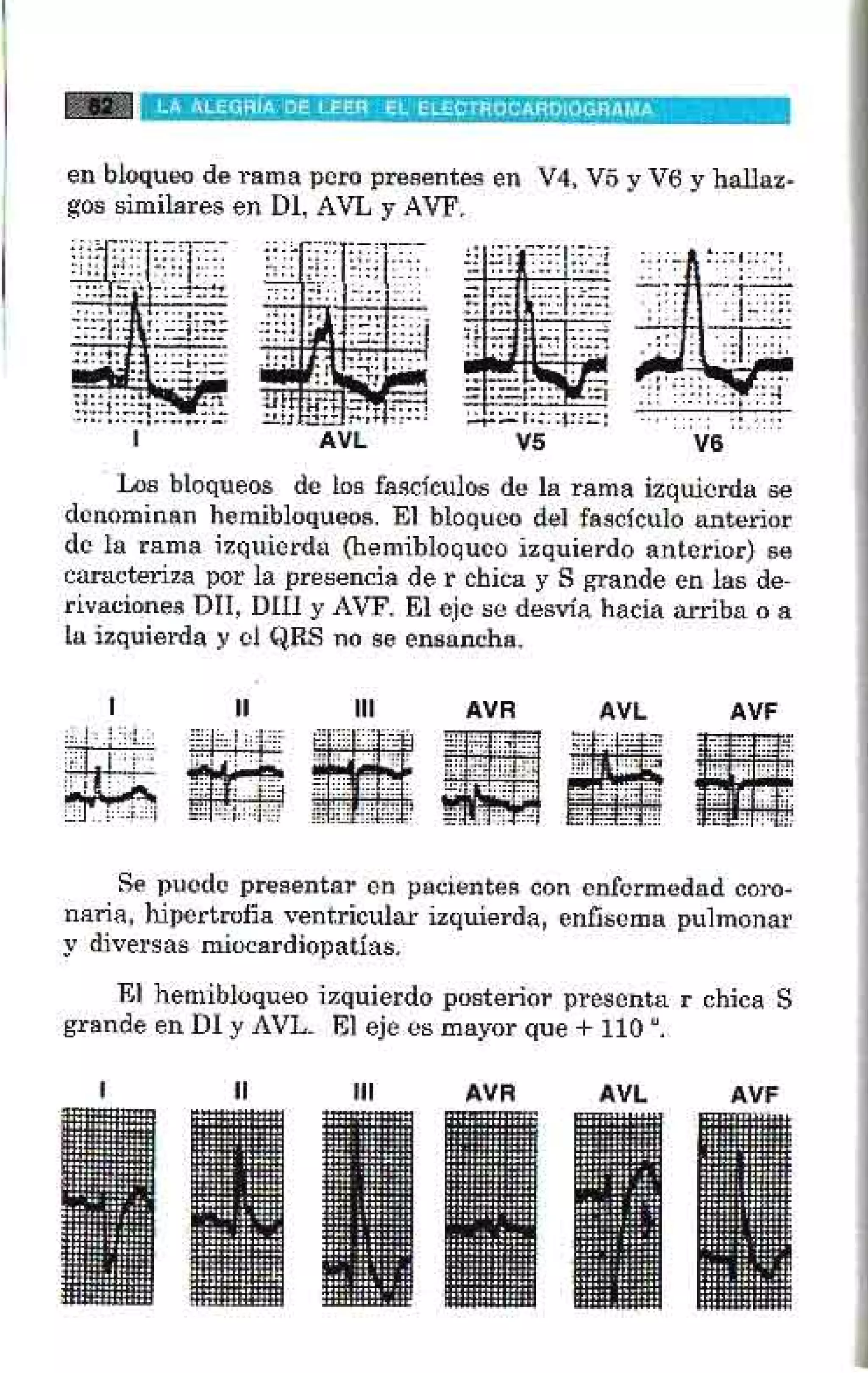 LA ALEGRIA DE LEER EL ELECTROCARDIOGRAMA