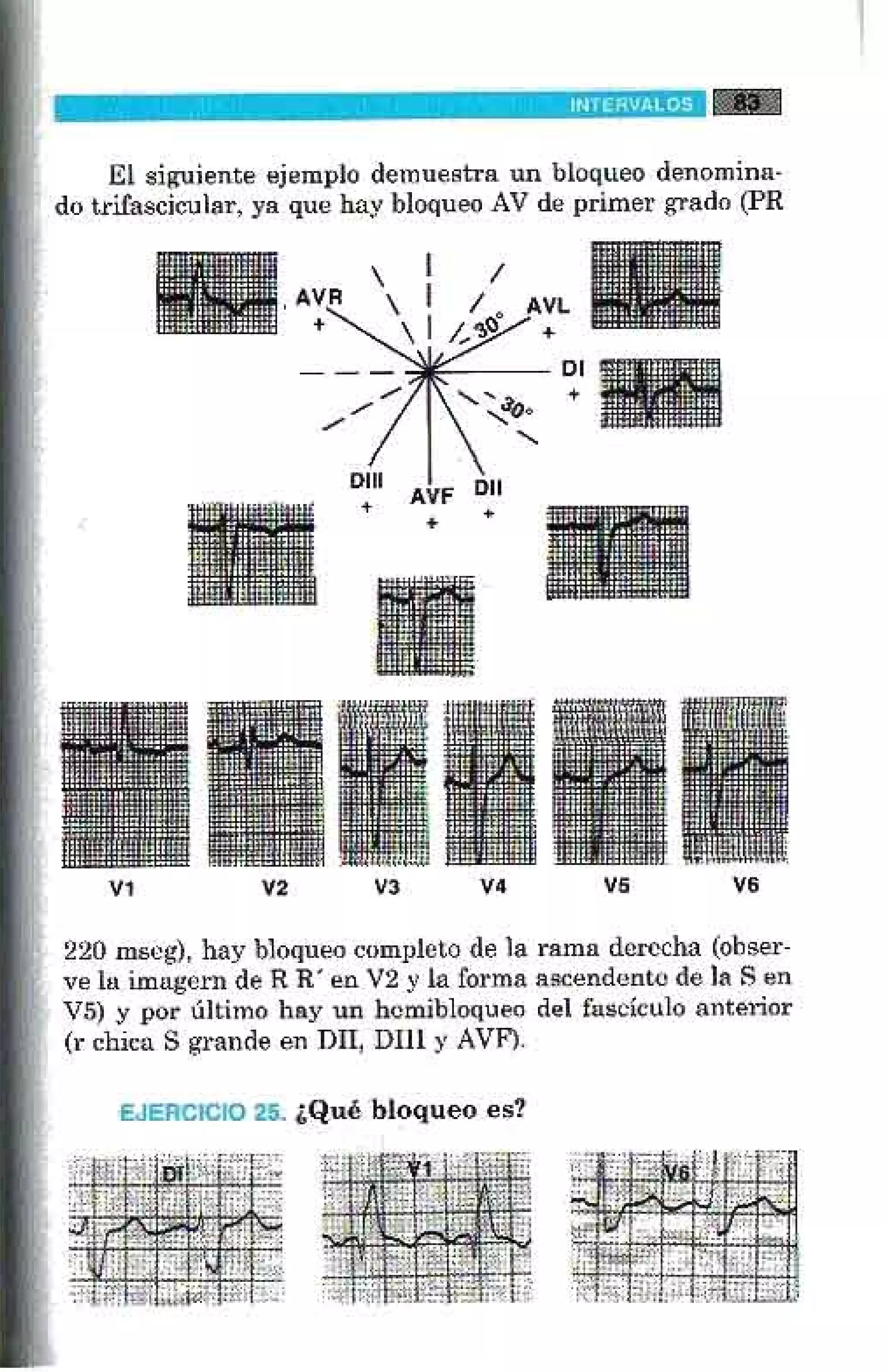 LA ALEGRIA DE LEER EL ELECTROCARDIOGRAMA