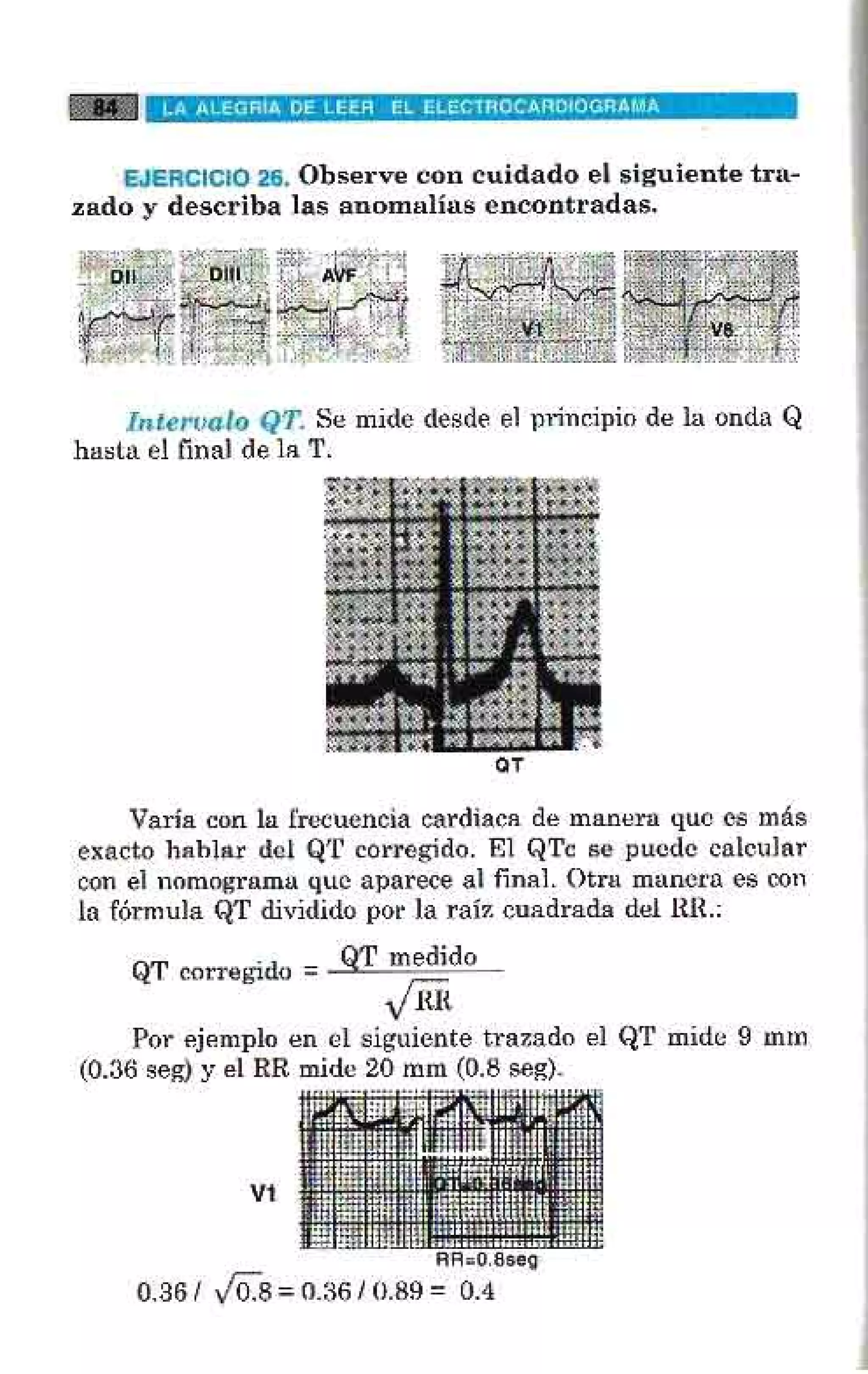 LA ALEGRIA DE LEER EL ELECTROCARDIOGRAMA