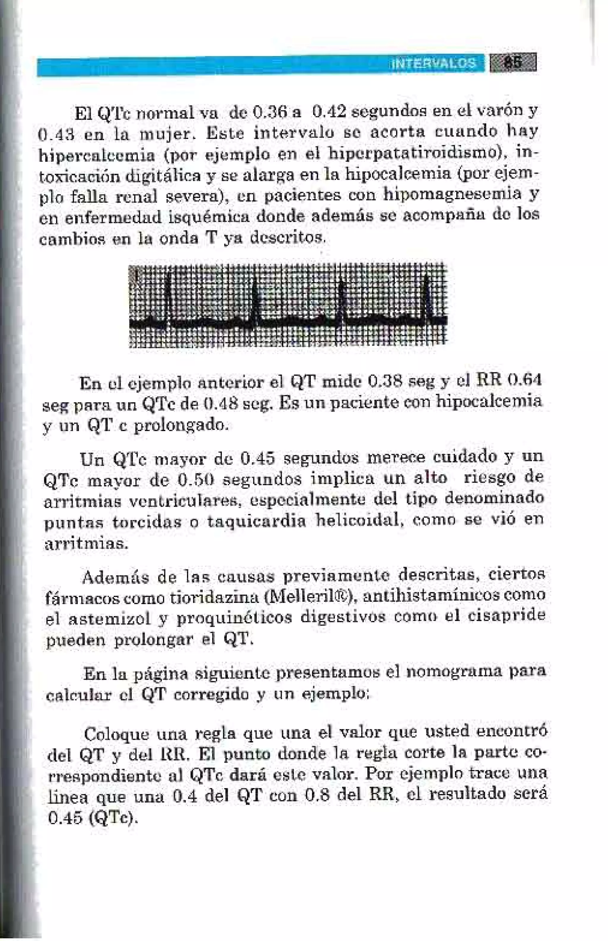 LA ALEGRIA DE LEER EL ELECTROCARDIOGRAMA