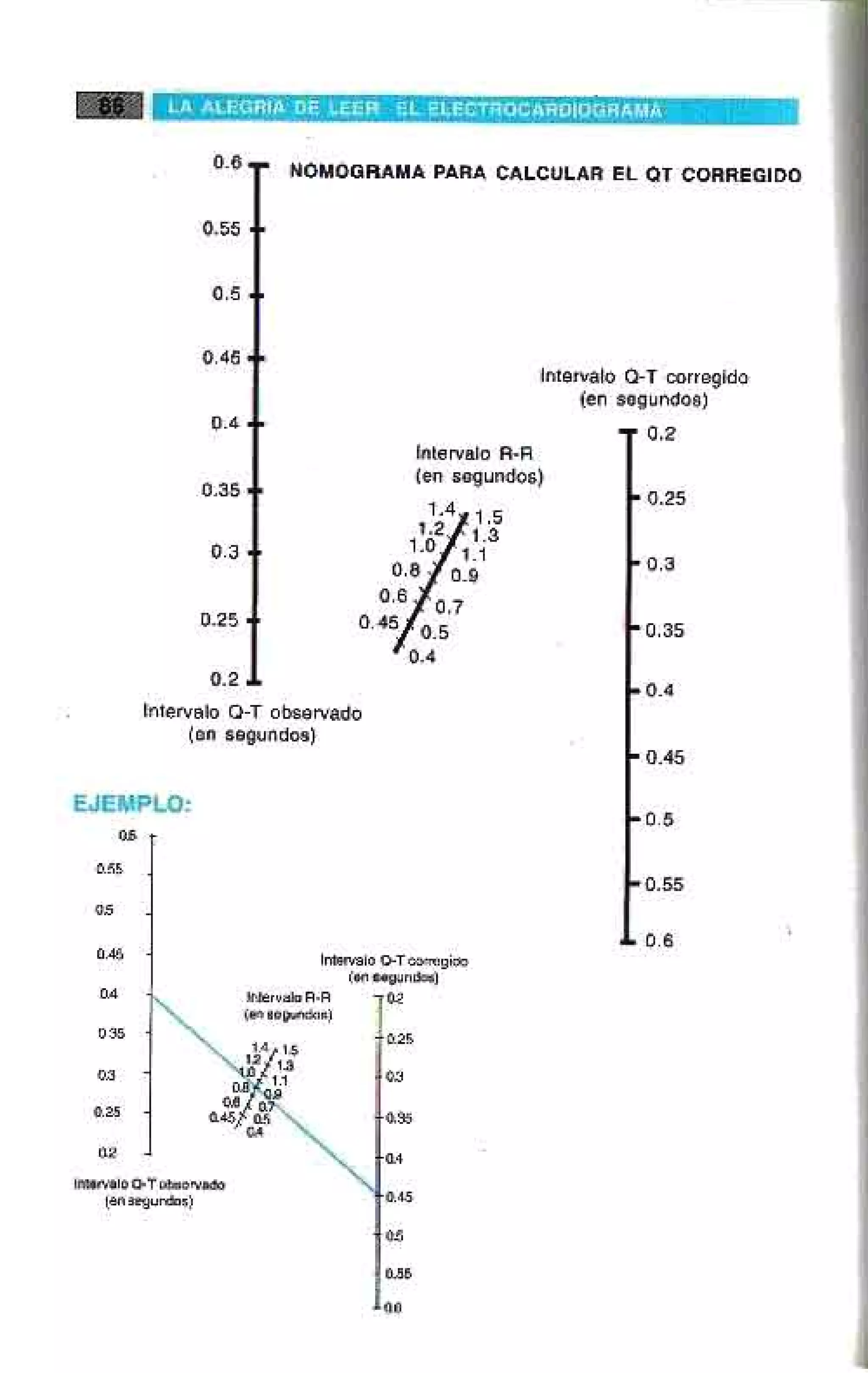 LA ALEGRIA DE LEER EL ELECTROCARDIOGRAMA