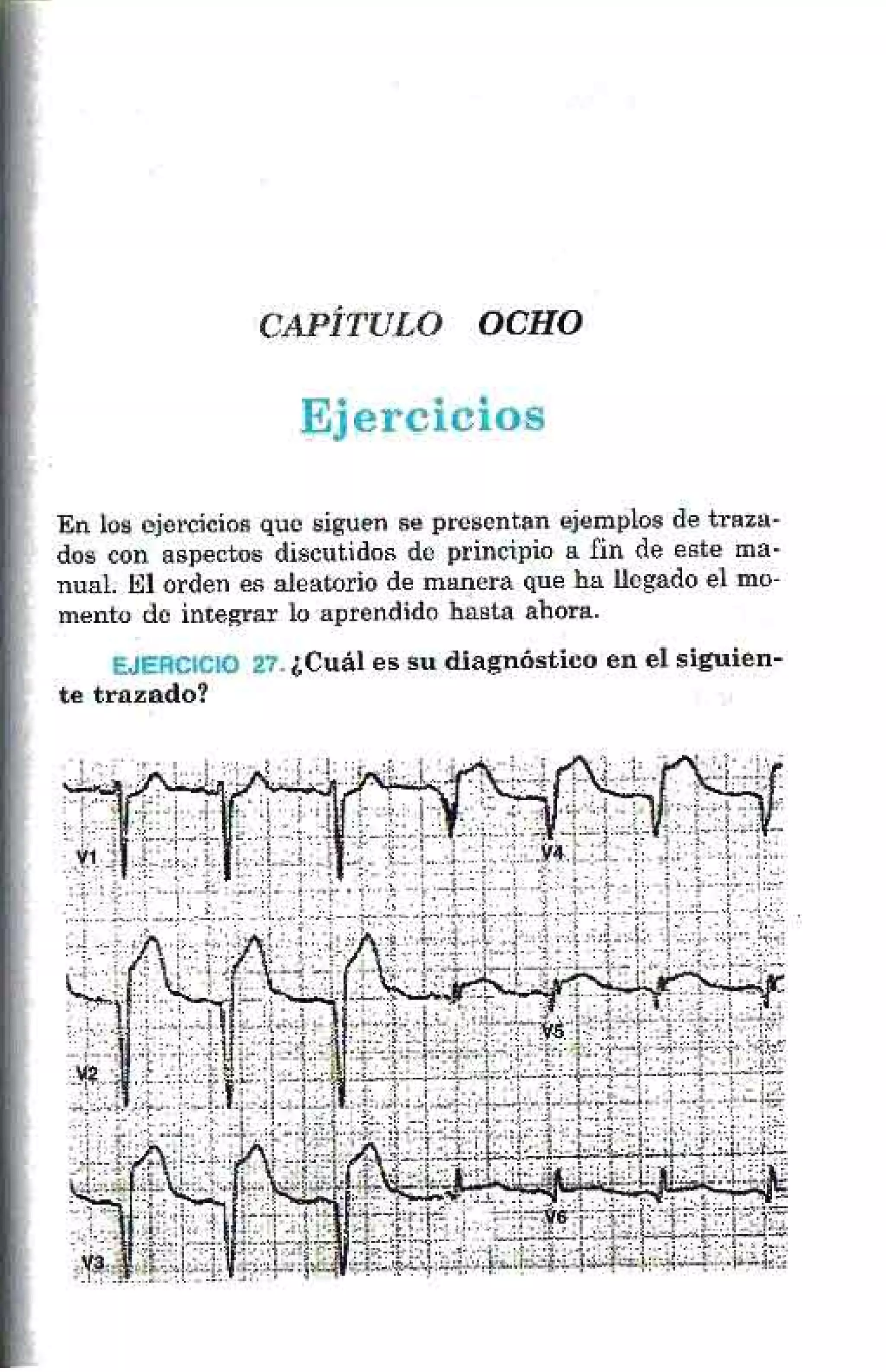 LA ALEGRIA DE LEER EL ELECTROCARDIOGRAMA