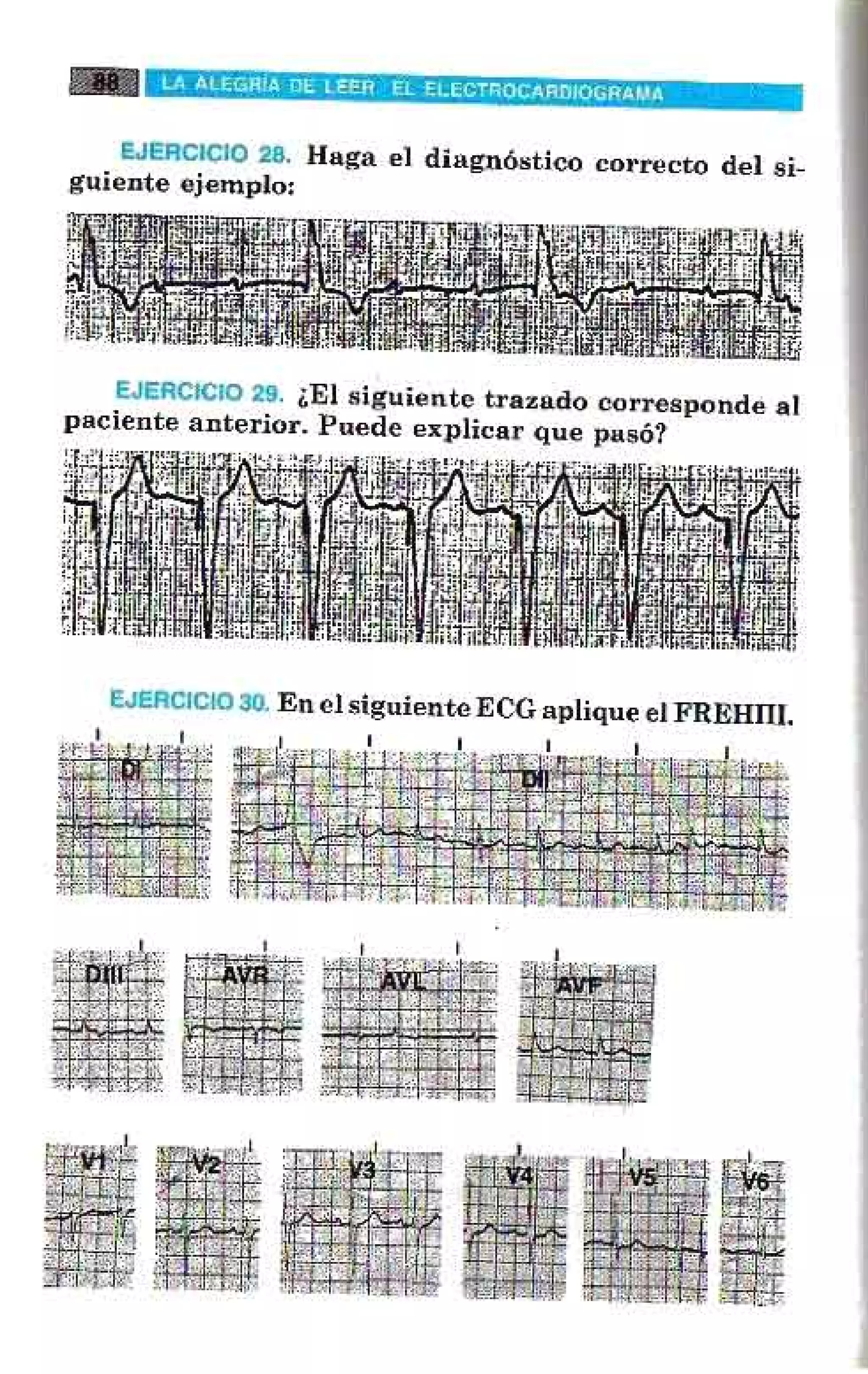 LA ALEGRIA DE LEER EL ELECTROCARDIOGRAMA