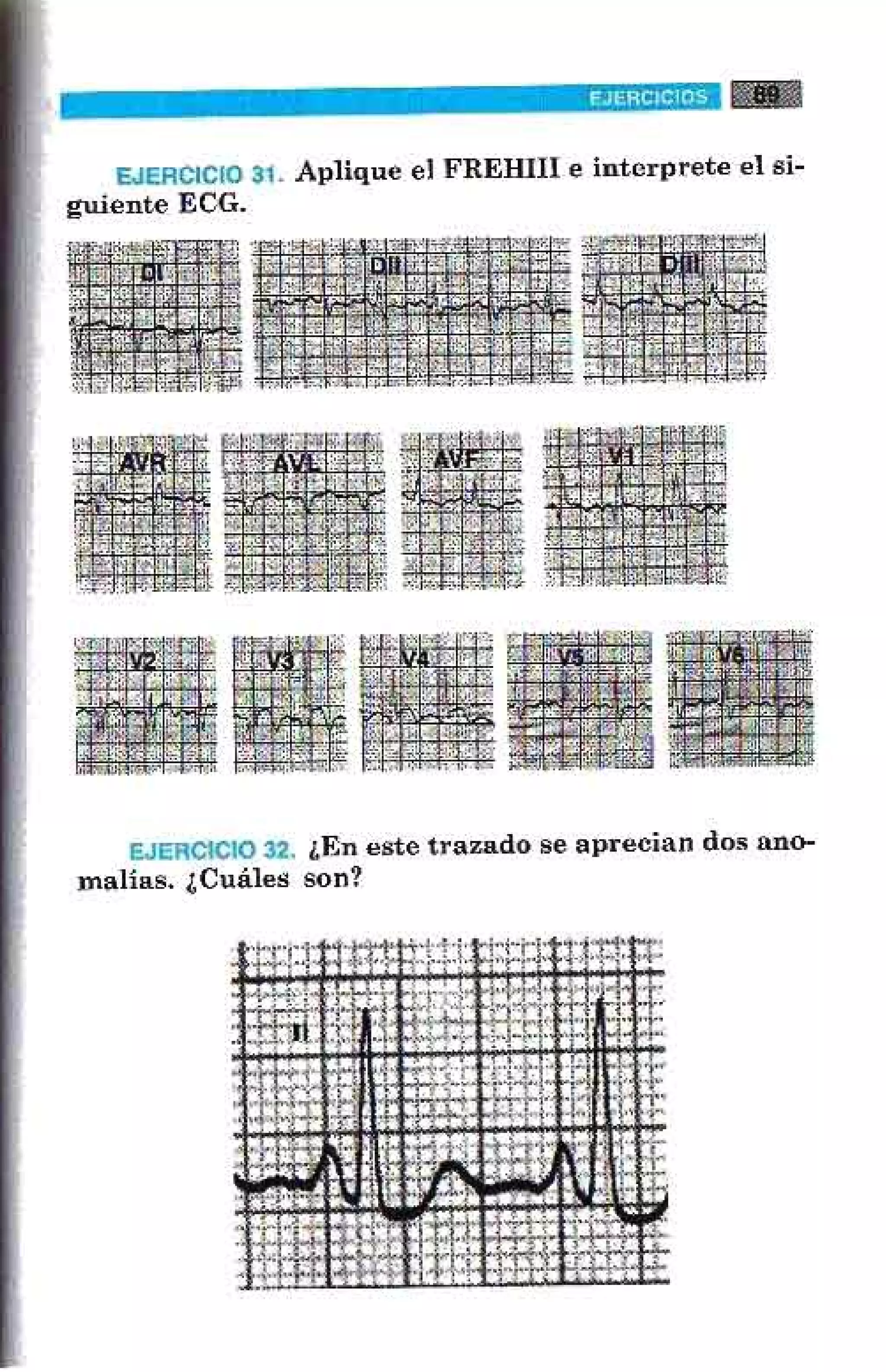 LA ALEGRIA DE LEER EL ELECTROCARDIOGRAMA