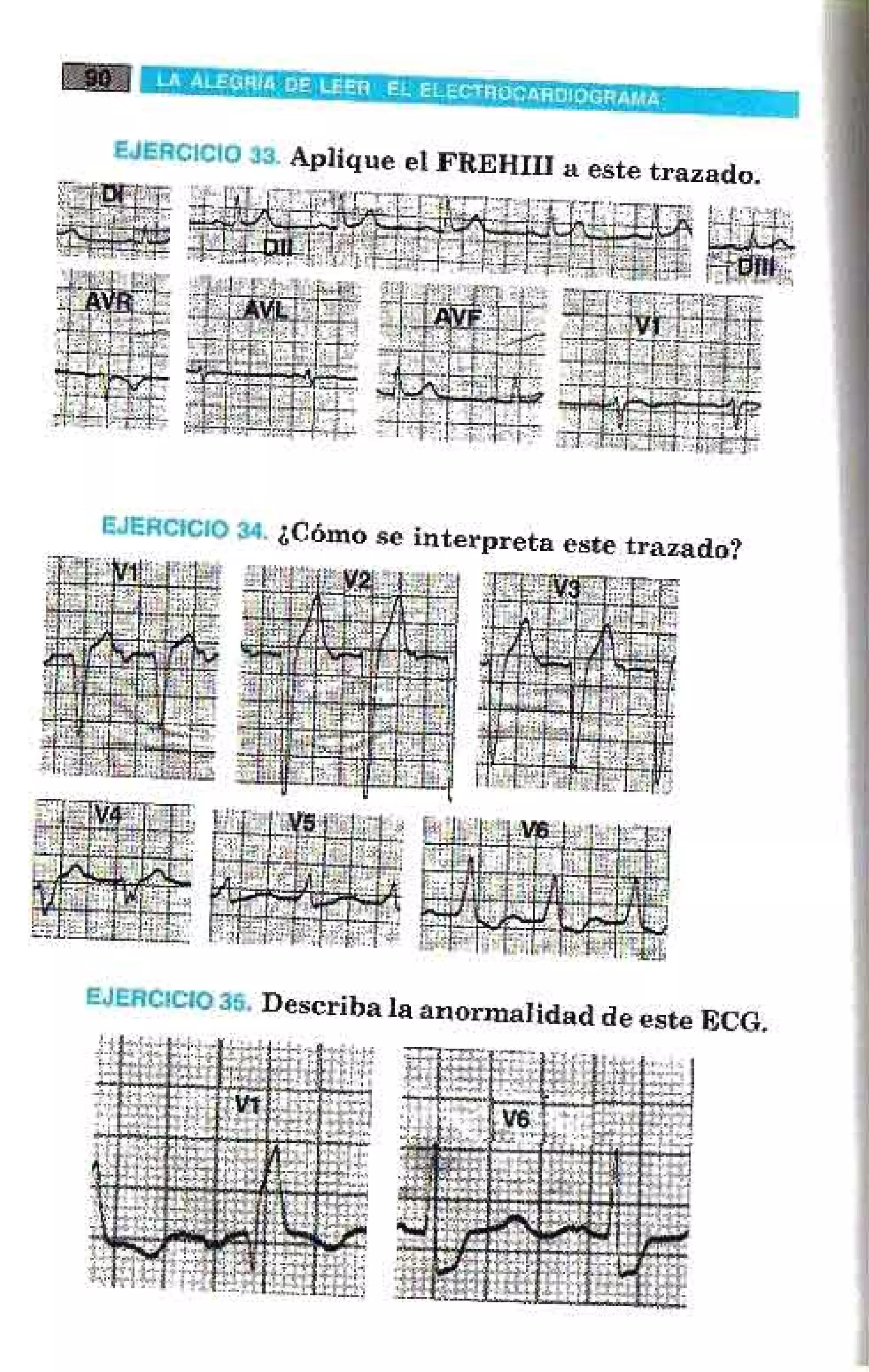 LA ALEGRIA DE LEER EL ELECTROCARDIOGRAMA