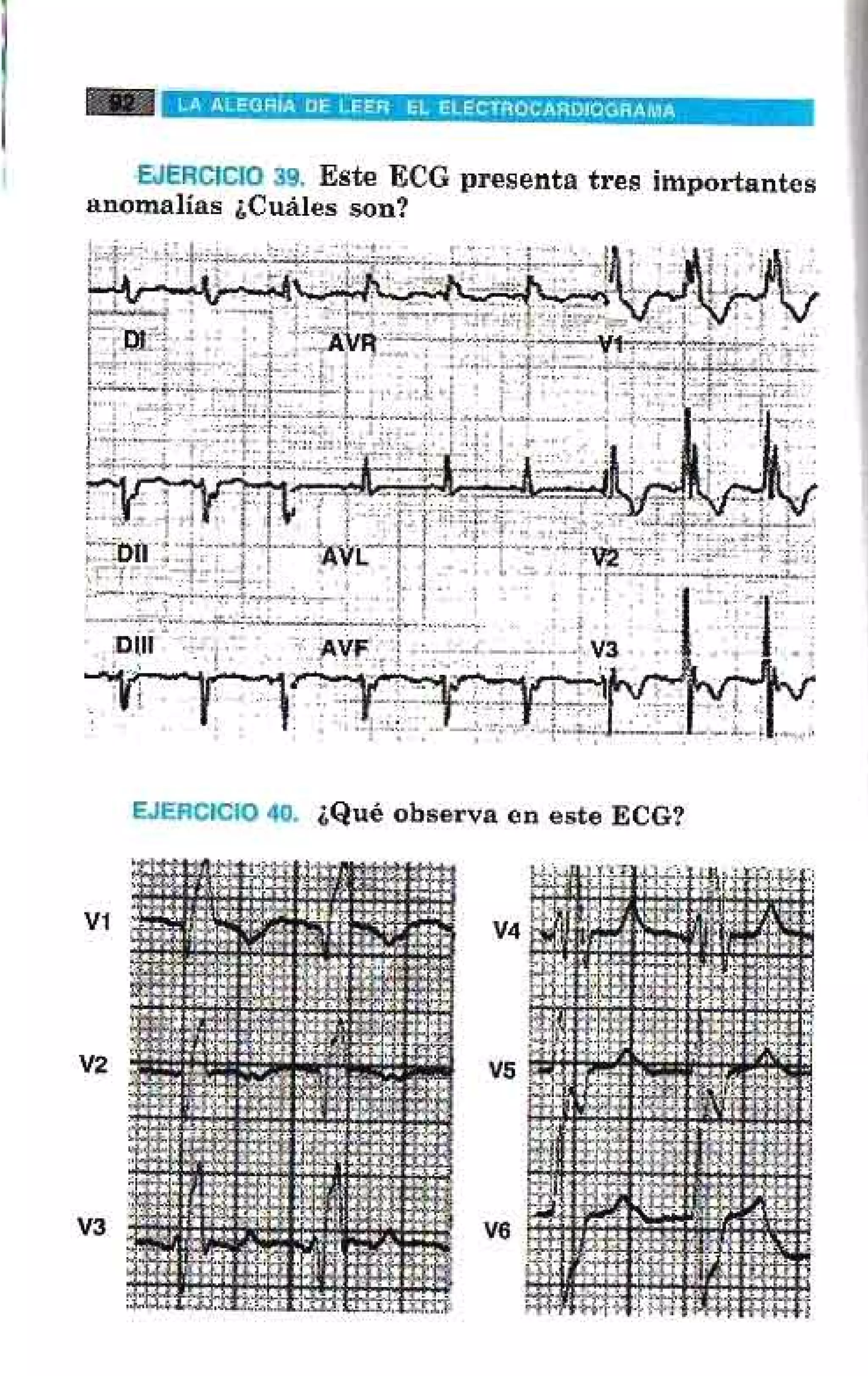 LA ALEGRIA DE LEER EL ELECTROCARDIOGRAMA