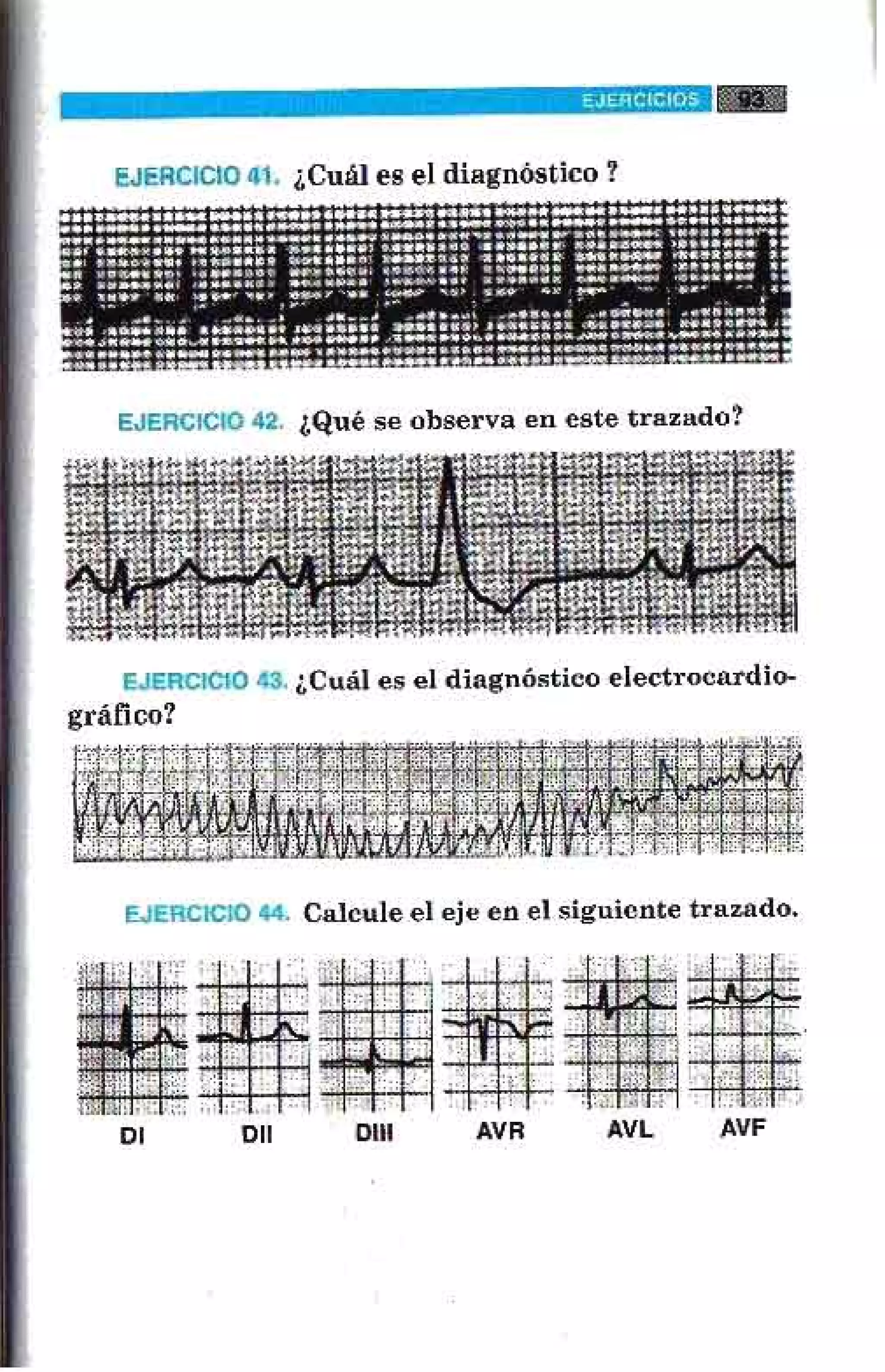LA ALEGRIA DE LEER EL ELECTROCARDIOGRAMA