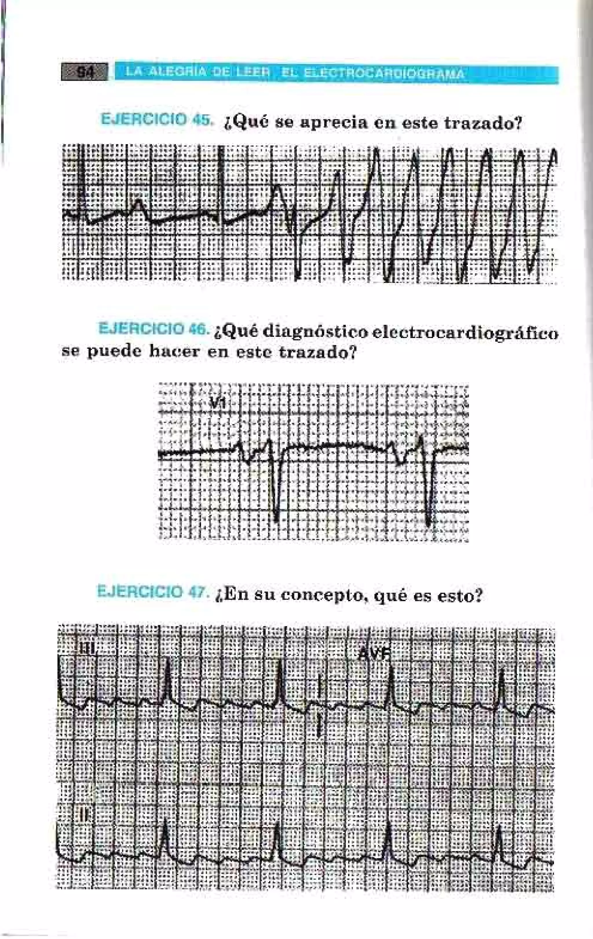 LA ALEGRIA DE LEER EL ELECTROCARDIOGRAMA