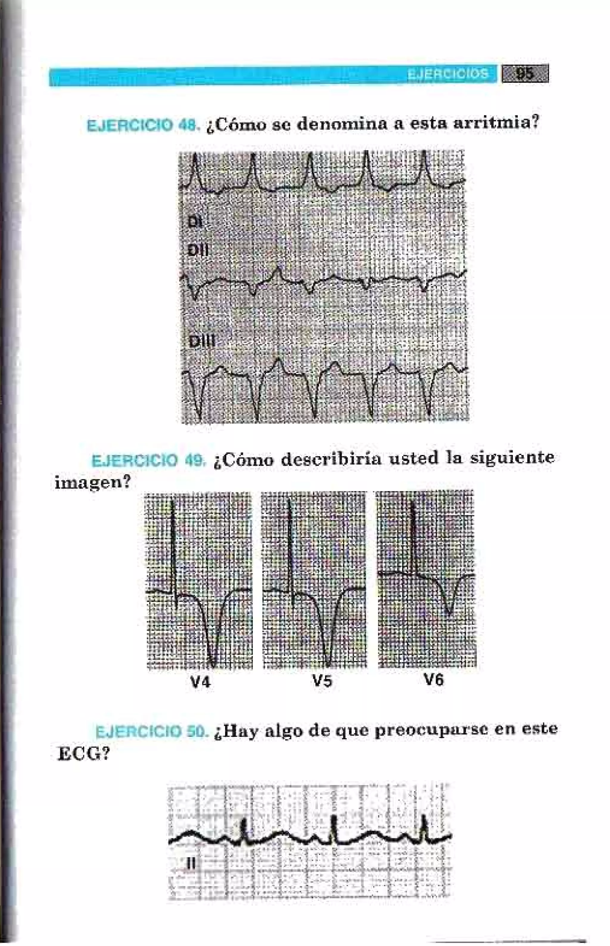 LA ALEGRIA DE LEER EL ELECTROCARDIOGRAMA