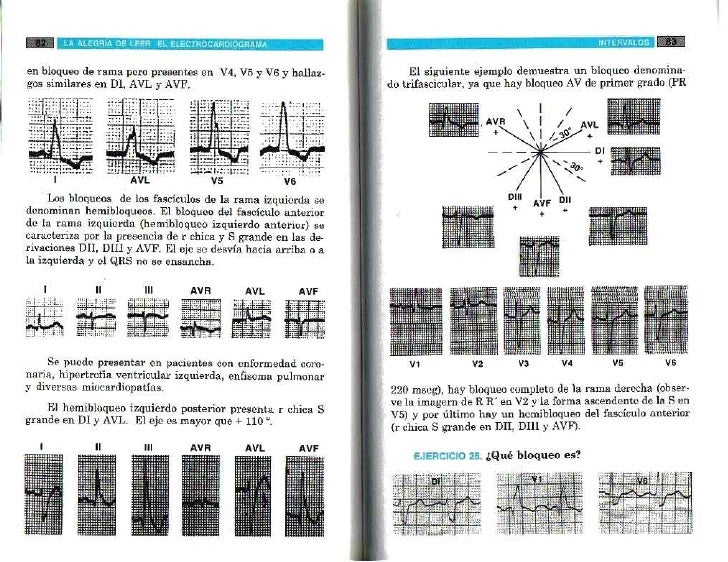 Conclusion Electrocardiograma Pdf