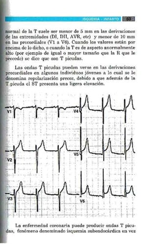 La alegria de_leer_ecg_lopez