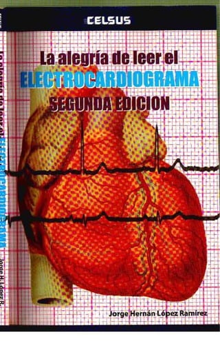 La alegría de leer un Electrocardiograma 