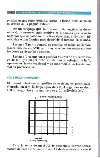 La alegria de leer electrocardiograma