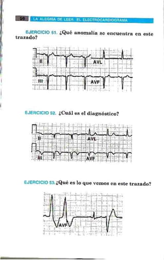 La alegria de leer electrocardiograma