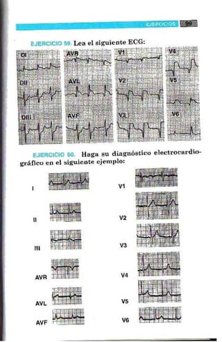 La alegria de leer electrocardiograma
