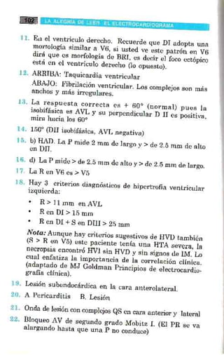 La alegria de leer electrocardiograma