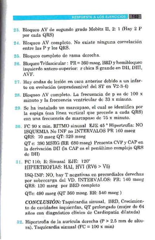 La alegria de leer electrocardiograma