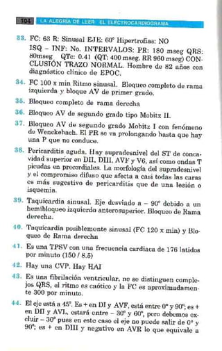La alegria de leer electrocardiograma