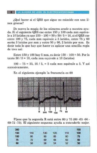 La alegria de leer electrocardiograma