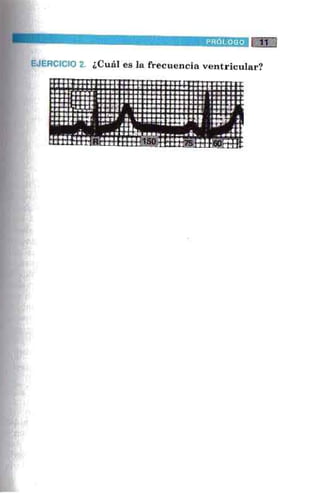 La alegria de leer electrocardiograma