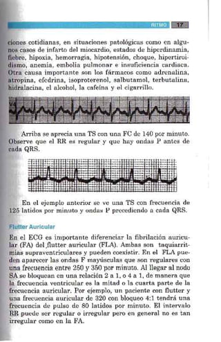 La alegria de leer electrocardiograma
