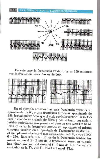 La alegria de leer electrocardiograma