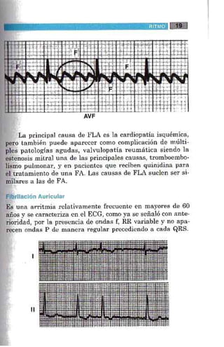 La alegria de leer electrocardiograma