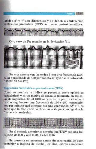 La alegria de leer electrocardiograma