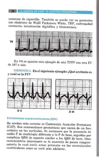 La alegria de leer electrocardiograma