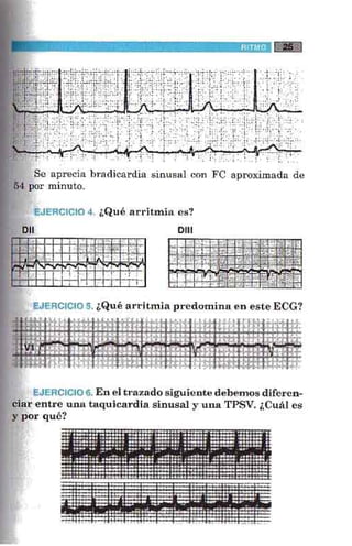 La alegria de leer electrocardiograma