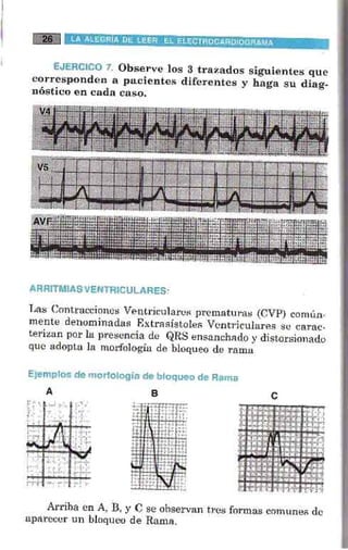 La alegria de leer electrocardiograma