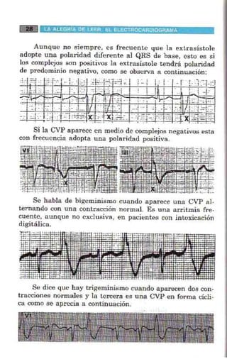 La alegria de leer electrocardiograma