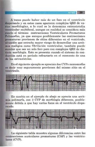 La alegria de leer electrocardiograma