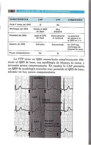 La alegria de leer electrocardiograma