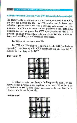 La alegria de leer electrocardiograma