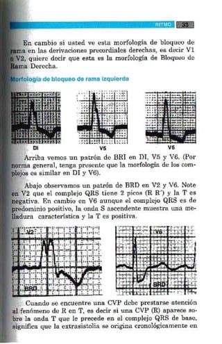La alegria de leer electrocardiograma