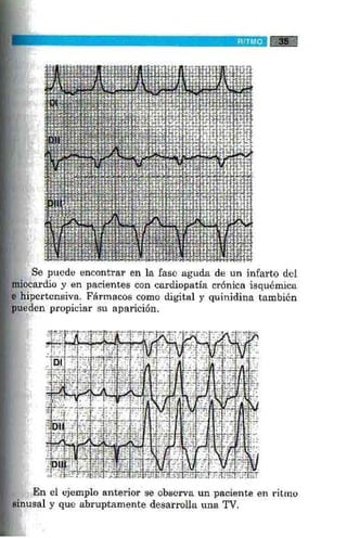 La alegria de leer electrocardiograma