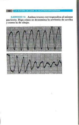 La alegria de leer electrocardiograma