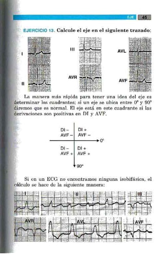 La alegria de leer electrocardiograma