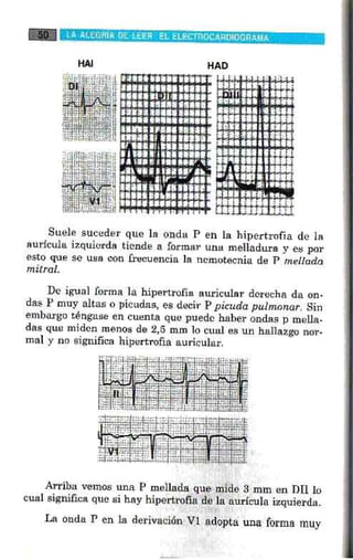 La alegria de leer electrocardiograma
