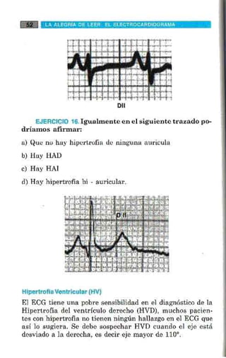 La alegria de leer electrocardiograma